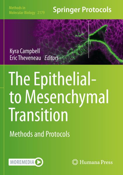 Produktbild: The Epithelial-to Mesenchymal Transition