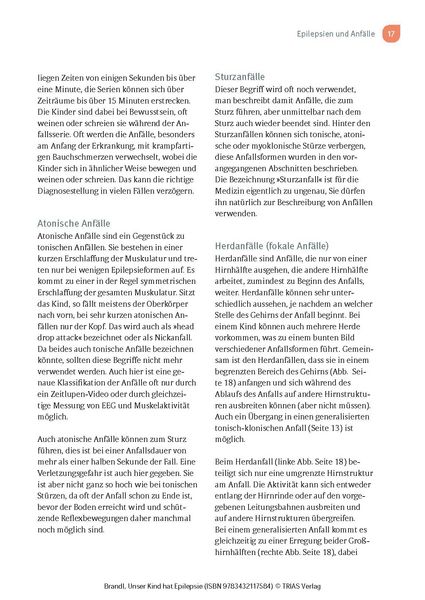 Produktbild: Unser Kind hat Epilepsie