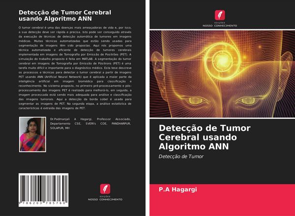 Produktbild: Detec&ccedil;&atilde;o de Tumor Cerebral usando Algoritmo ANN