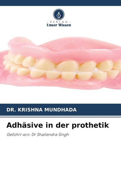Produktbild: Adh&auml;sive in der prothetik