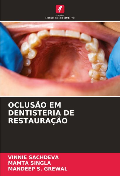 Produktbild: OCLUS&Atilde;O EM DENTISTERIA DE RESTAURA&Ccedil;&Atilde;O