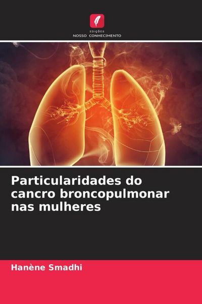 Produktbild: Particularidades do cancro broncopulmonar nas mulheres