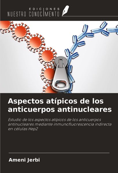 Produktbild: Aspectos at&iacute;picos de los anticuerpos antinucleares