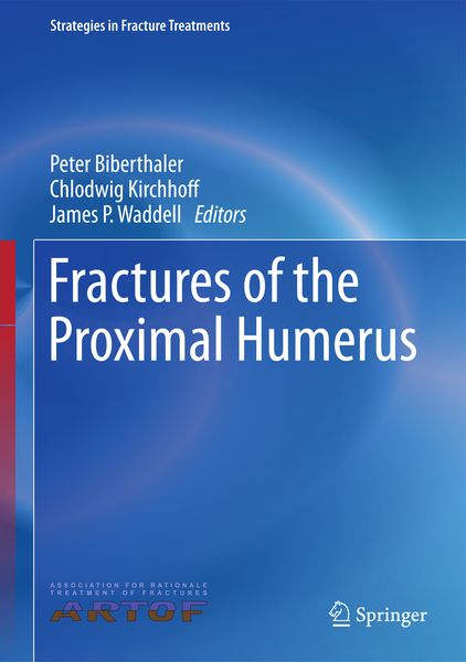 Produktbild: Fractures of the Proximal Humerus