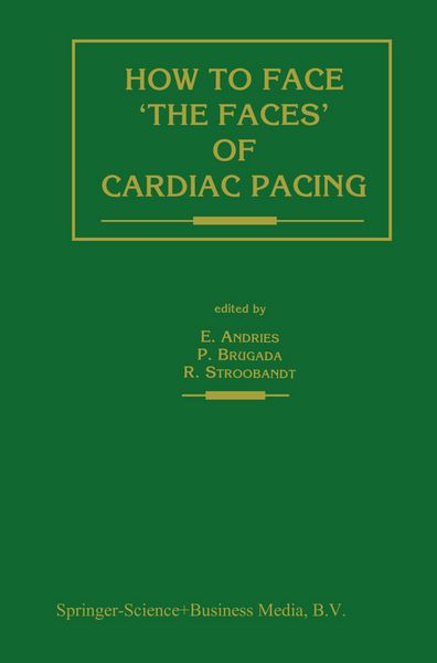 Produktbild: How to face &lsquo;the faces&rsquo; of CARDIAC PACING