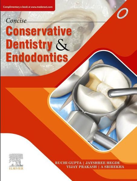 Produktbild: Concise Conservative Dentistry and Endodontics- E Book