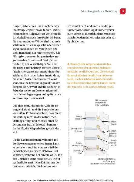 Produktbild: Der R&uuml;cken-Doc: Wirbels&auml;ulen-Arthrose