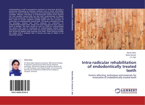 Produktbild: Intra-radicular rehabilitation of endodontically treated teeth
