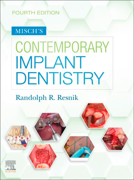 Produktbild: Misch's Contemporary Implant Dentistry E-Book