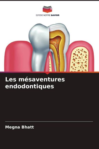 Produktbild: Les m&eacute;saventures endodontiques