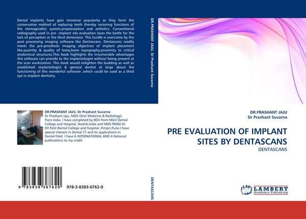 Produktbild: Pre Evaluation Of Implant Sites By Dentascans