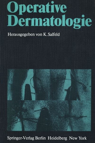 Operative Dermatologie, Taschenbuch von , Springer Berlin, 9783540094975