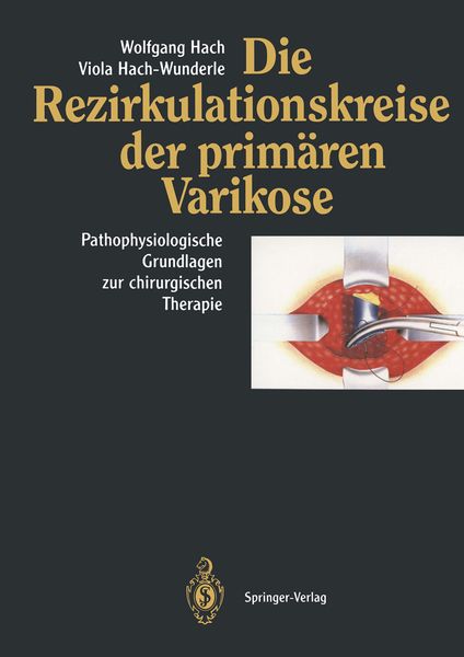 Produktbild: Die Rezirkulationskreise der prim&auml;ren Varikose