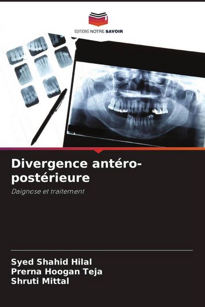 Produktbild: Divergence ant&eacute;ro-post&eacute;rieure