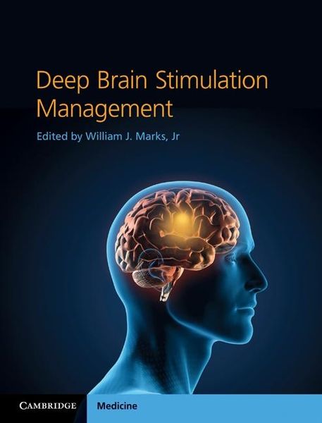 Produktbild: Deep Brain Stimulation Management