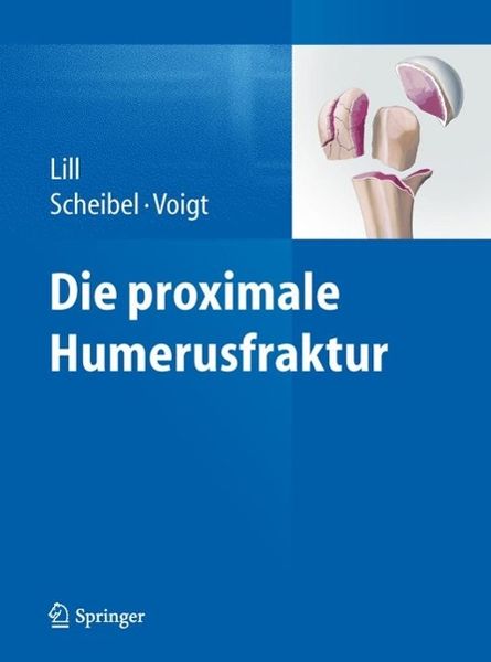 Produktbild: Die proximale Humerusfraktur