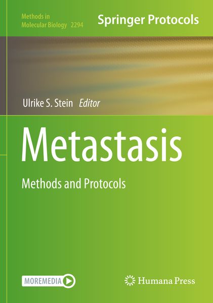 Produktbild: Metastasis