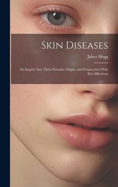 Produktbild: Skin Diseases; An Inquiry Into Their Parasitic Origin, and Connection With Eye Affections