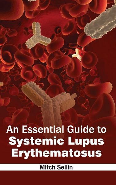 Produktbild: An Essential Guide to Systemic Lupus Erythematosus