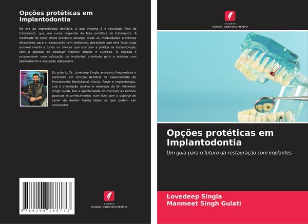 Produktbild: Op&ccedil;&otilde;es prot&eacute;ticas em Implantodontia