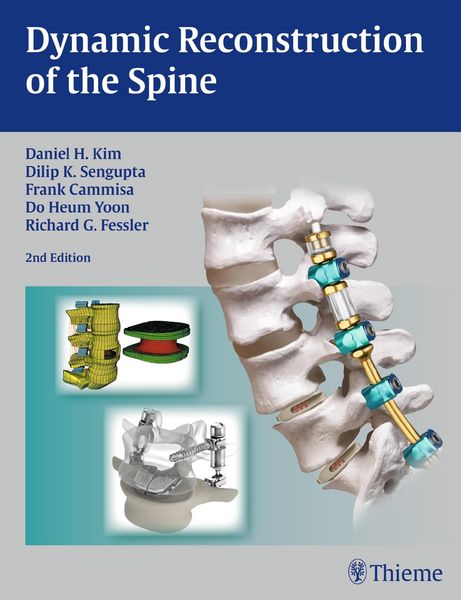 Produktbild: Dynamic Reconstruction of the Spine
