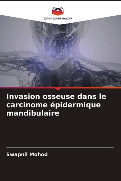 Produktbild: Invasion osseuse dans le carcinome &eacute;pidermique mandibulaire