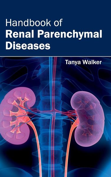 Produktbild: Handbook of Renal Parenchymal Diseases