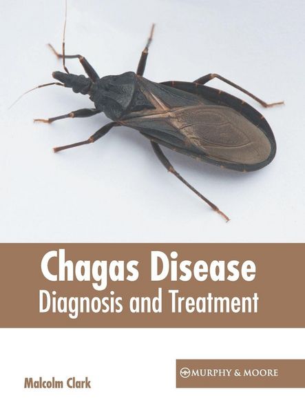 Produktbild: Chagas Disease: Diagnosis and Treatment