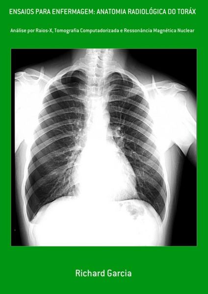 Produktbild: Ensaios Para Enfermagem: Anatomia Radiol&oacute;gica Do Tor&aacute;x