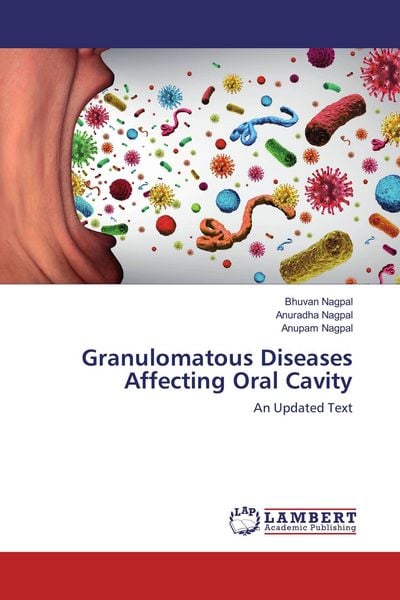 Produktbild: Granulomatous Diseases Affecting Oral Cavity