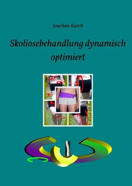 Produktbild: Skoliosebehandlung dynamisch optimiert