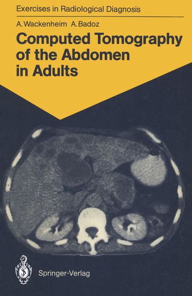 Produktbild: Computed Tomography of the Abdomen in Adults