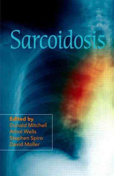 Produktbild: Sarcoidosis
