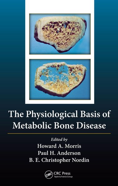 Produktbild: The Physiological Basis of Metabolic Bone Disease