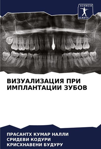 Produktbild: Vizualizaciya Pri Implantacii Zubov