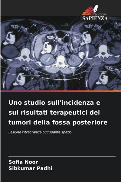 Produktbild: Uno studio sull'incidenza e sui risultati terapeutici dei tumori della fossa posteriore