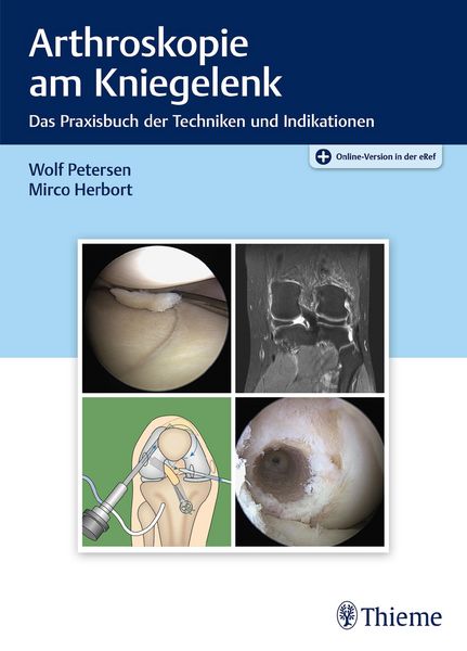 Produktbild: Arthroskopie am Kniegelenk