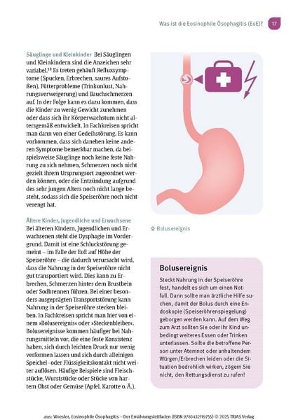 Produktbild: Eosinophile &Ouml;sophagitis - Der Ern&auml;hrungsleitfaden