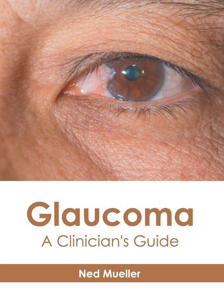 Produktbild: Glaucoma: A Clinician's Guide
