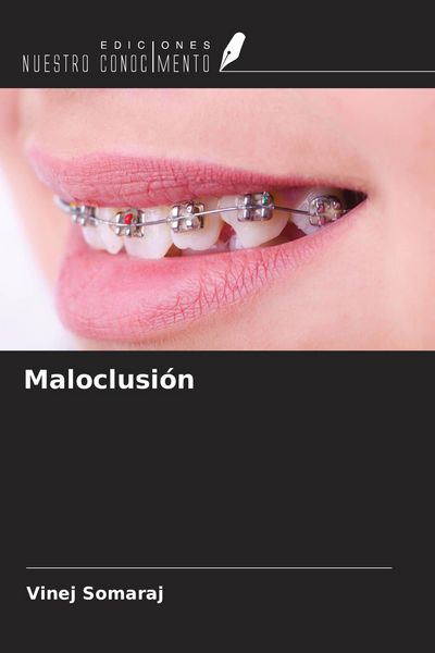 Produktbild: Maloclusi&oacute;n