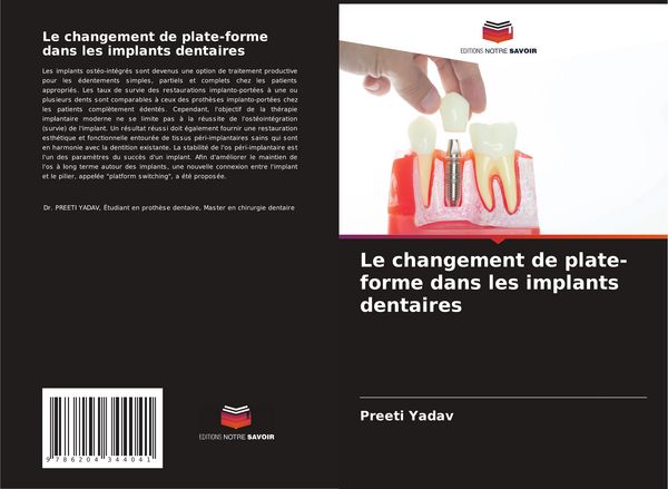 Produktbild: Le changement de plate-forme dans les implants dentaires