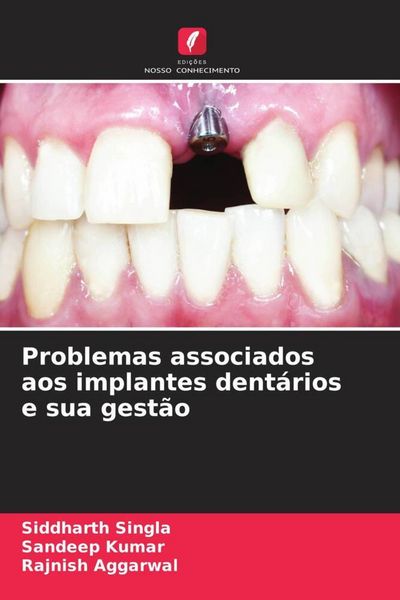 Produktbild: Problemas associados aos implantes dent&aacute;rios e sua gest&atilde;o