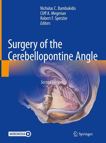 Produktbild: Surgery of the Cerebellopontine Angle