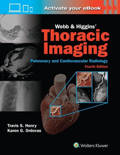 Produktbild: Webb & Higgins Thoracic Imaging: Print + eBook with Multimedia