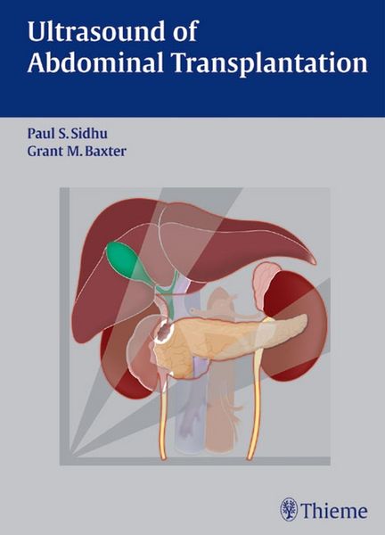 Produktbild: Ultrasound of Abdominal Transplantation