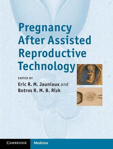 Produktbild: Pregnancy After Assisted Reproductive Technology
