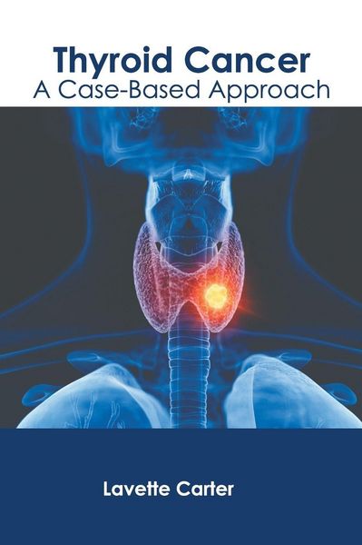 Produktbild: Thyroid Cancer: A Case-Based Approach