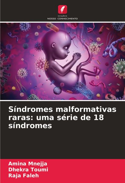 Produktbild: S&iacute;ndromes malformativas raras: uma s&eacute;rie de 18 s&iacute;ndromes