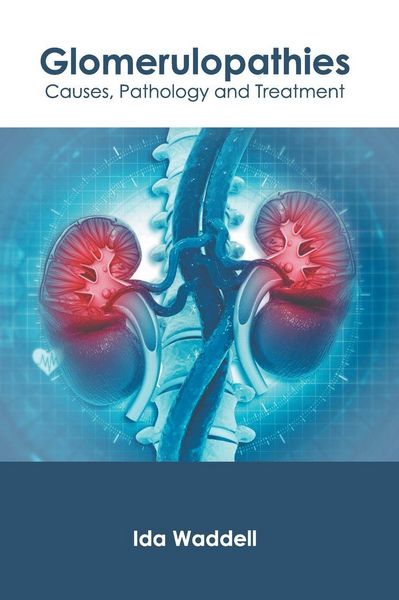 Produktbild: Glomerulopathies: Causes, Pathology and Treatment
