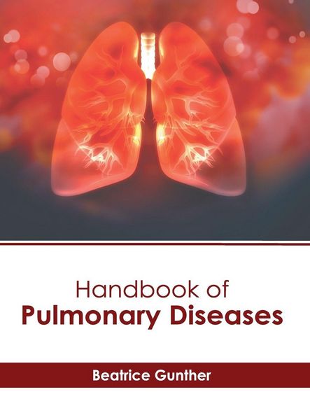 Produktbild: Handbook of Pulmonary Diseases